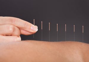 American College of Acupuncture- Safe Ancient Cure for Ailments Popular in The World Today!